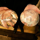Image for article titled 'I Was Not Warned': Patients Push FDA to Ban Cancer-Linked Breast Implants